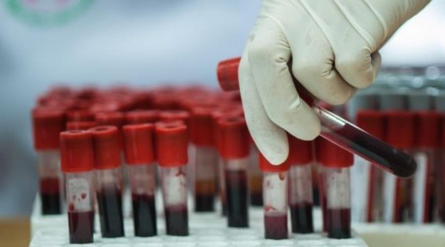 การกำหนด MCHC ในการทดสอบเลือด MCHC (การตรวจเลือด): ถอดรหัส, บรรทัดฐาน การเตรียมการและการทำวิจัย