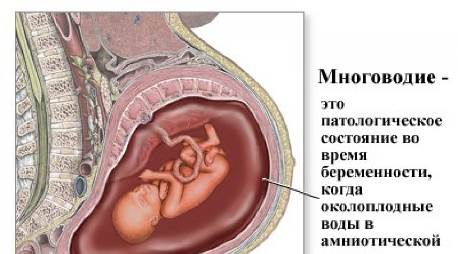 Хламидиоз у беременных