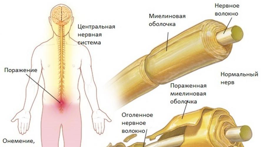 Wandering nerve in the chest. What is nervous Vagus - the location, structure and functions, symptoms and treatment of diseases. Tools for strengthening nerves